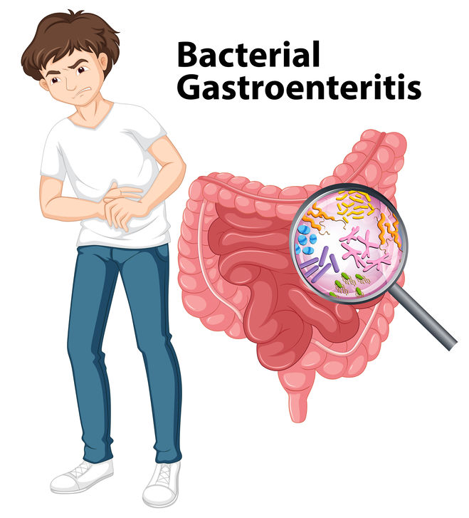 Man and diagram showing bacterial gastroenteritis illustration