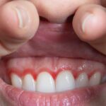 El parabrisas de tu coche tiene cientos de pequeños puntos negros. No es decoración, es tecnología para salvarnos la vida